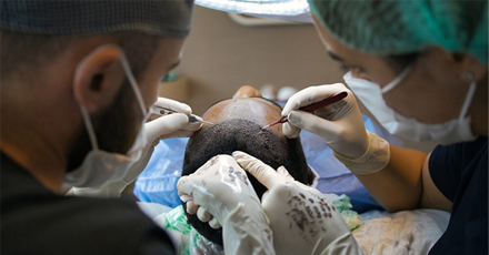 Afro Hair Transplant Procedure at Monarch Clinic Chester