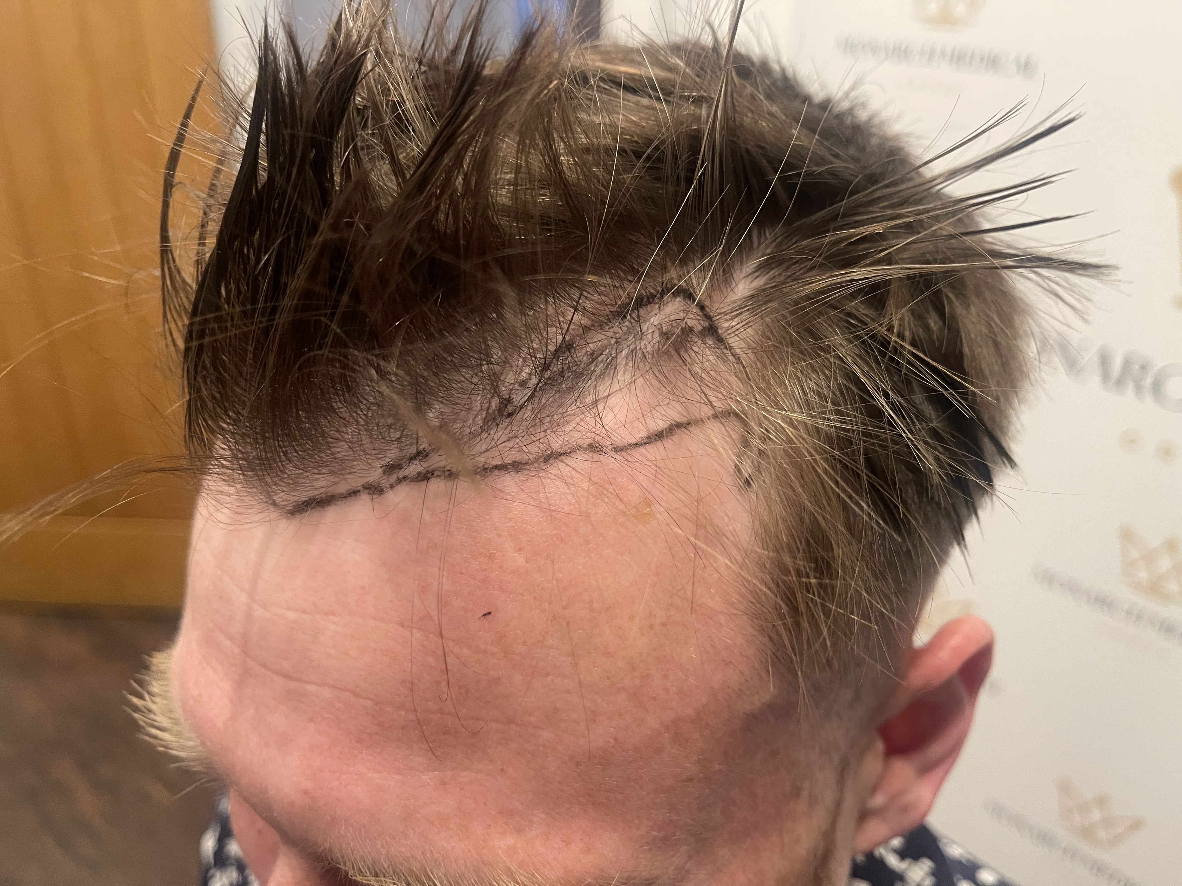 Ashley Reed hair restoration photo 2