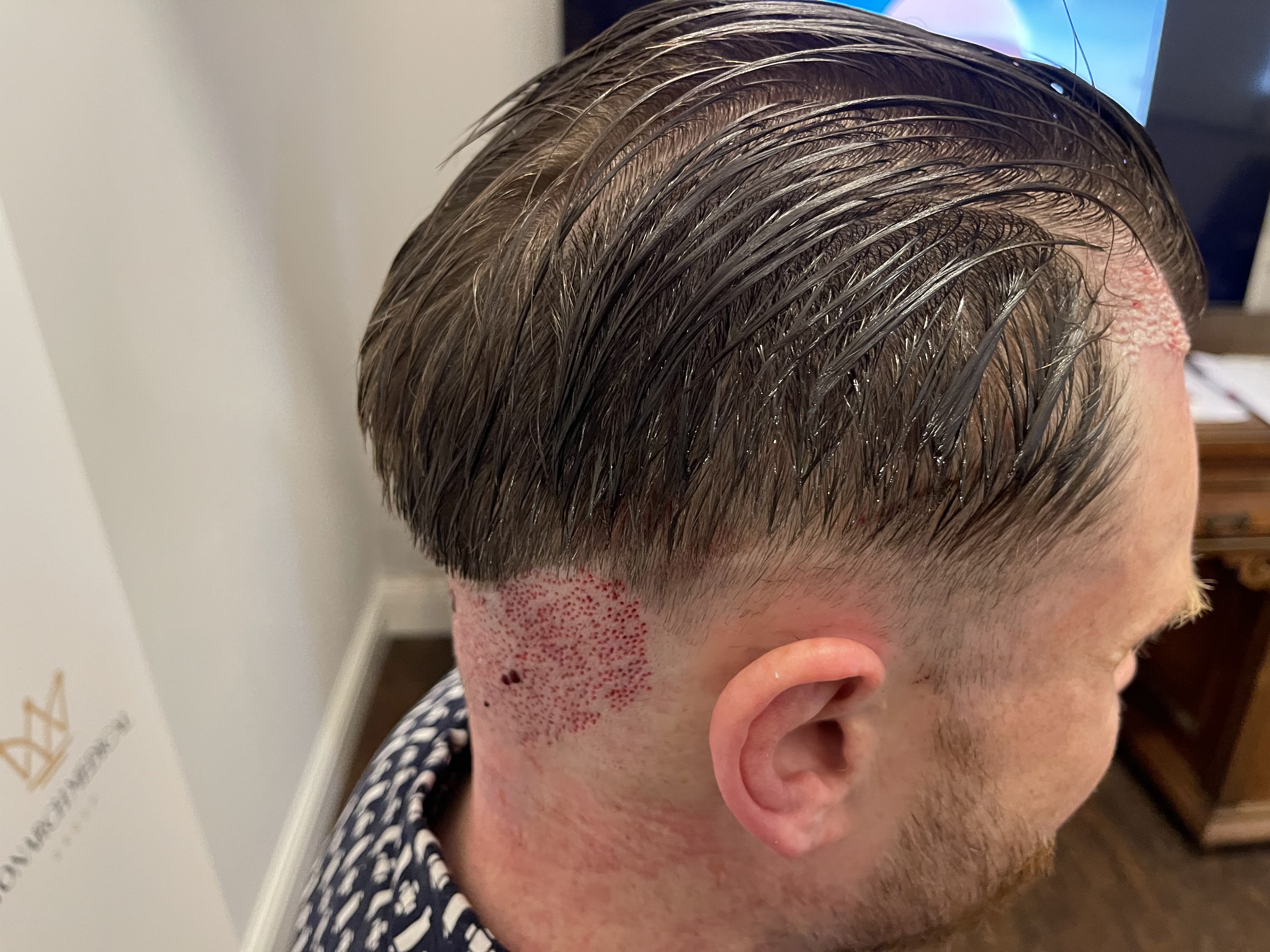 Ashley Reed hair restoration photo 4