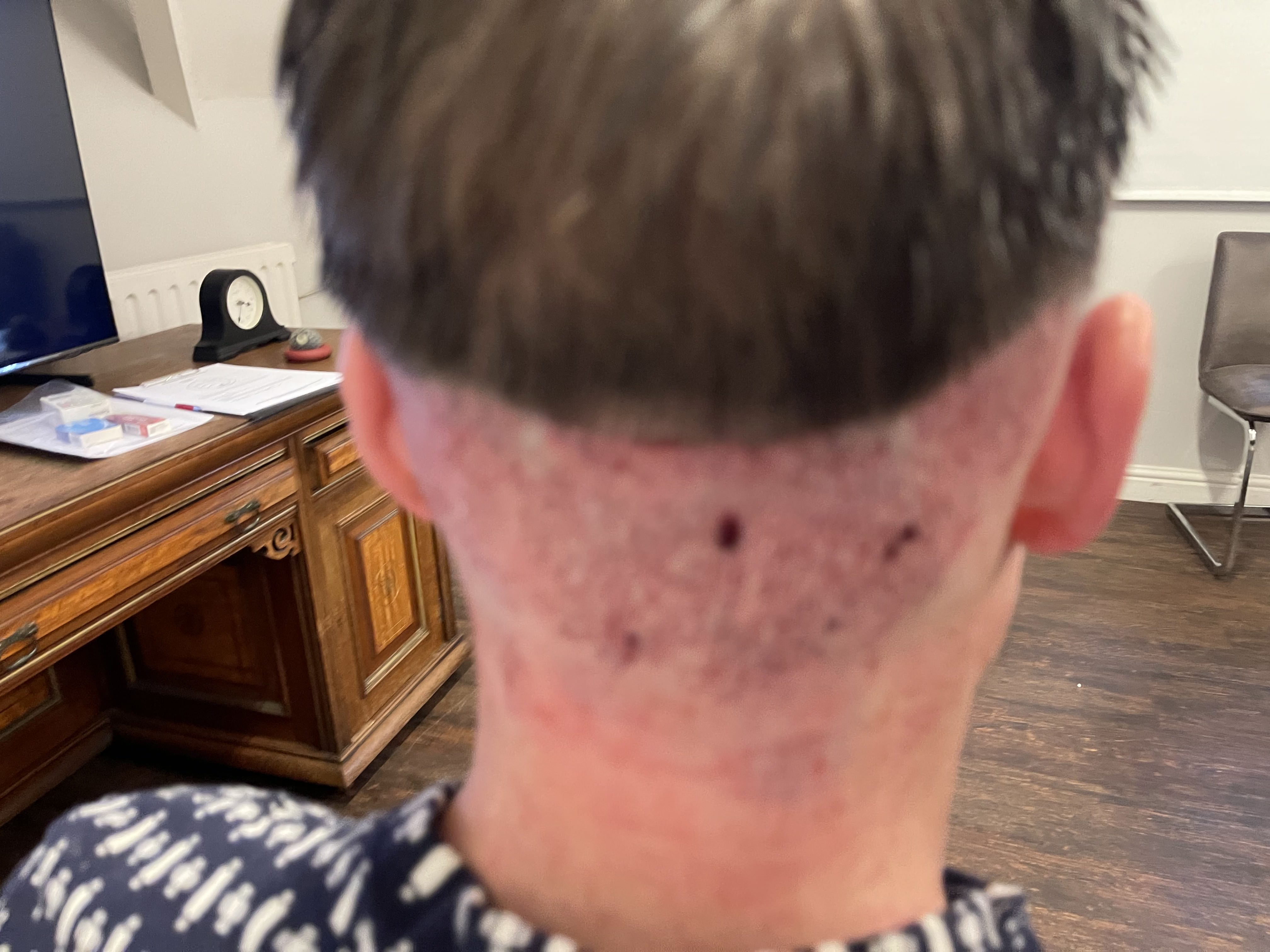 Ashley Reed hair restoration photo 5