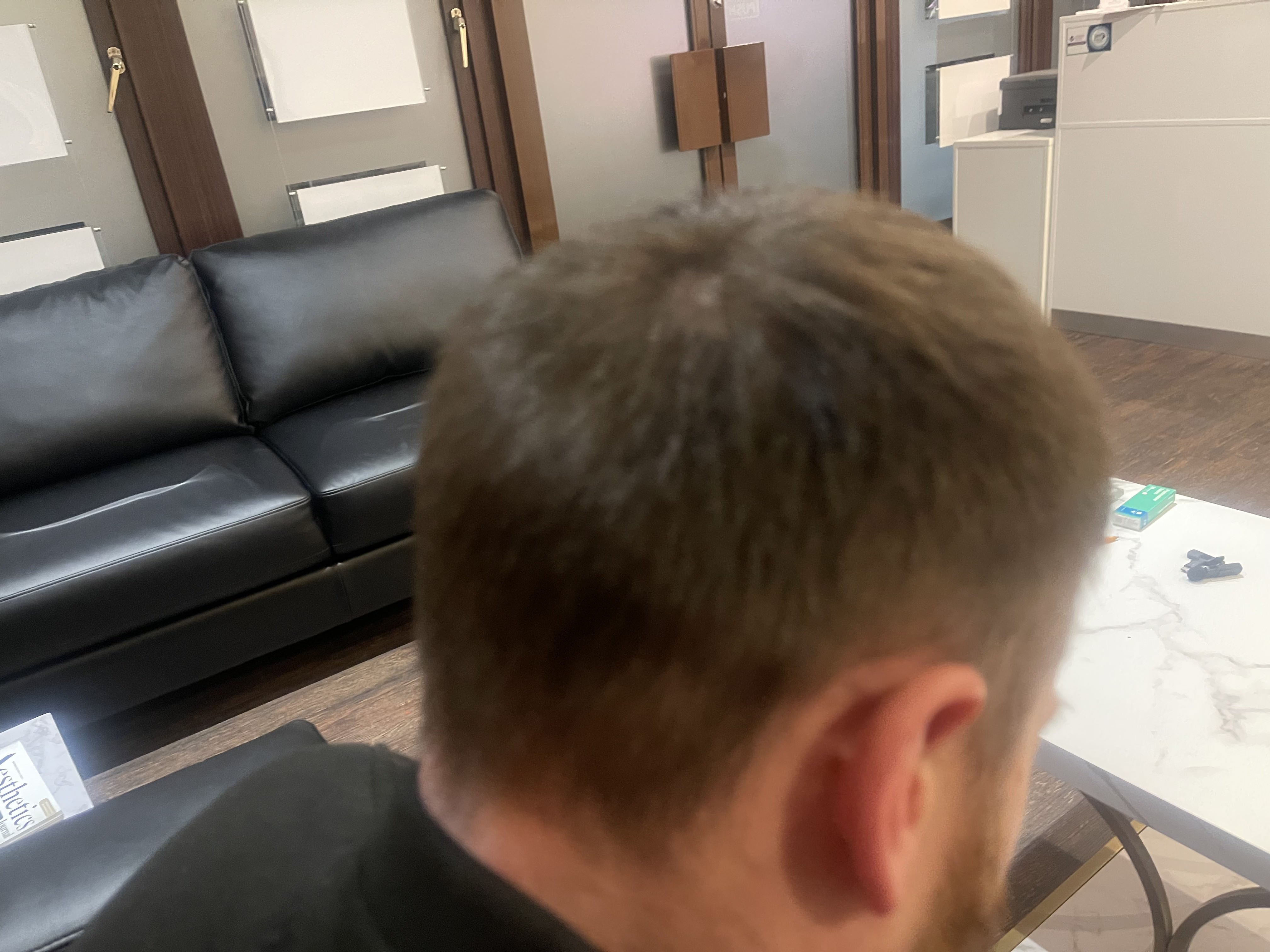 Ashley Reed hair restoration photo 6