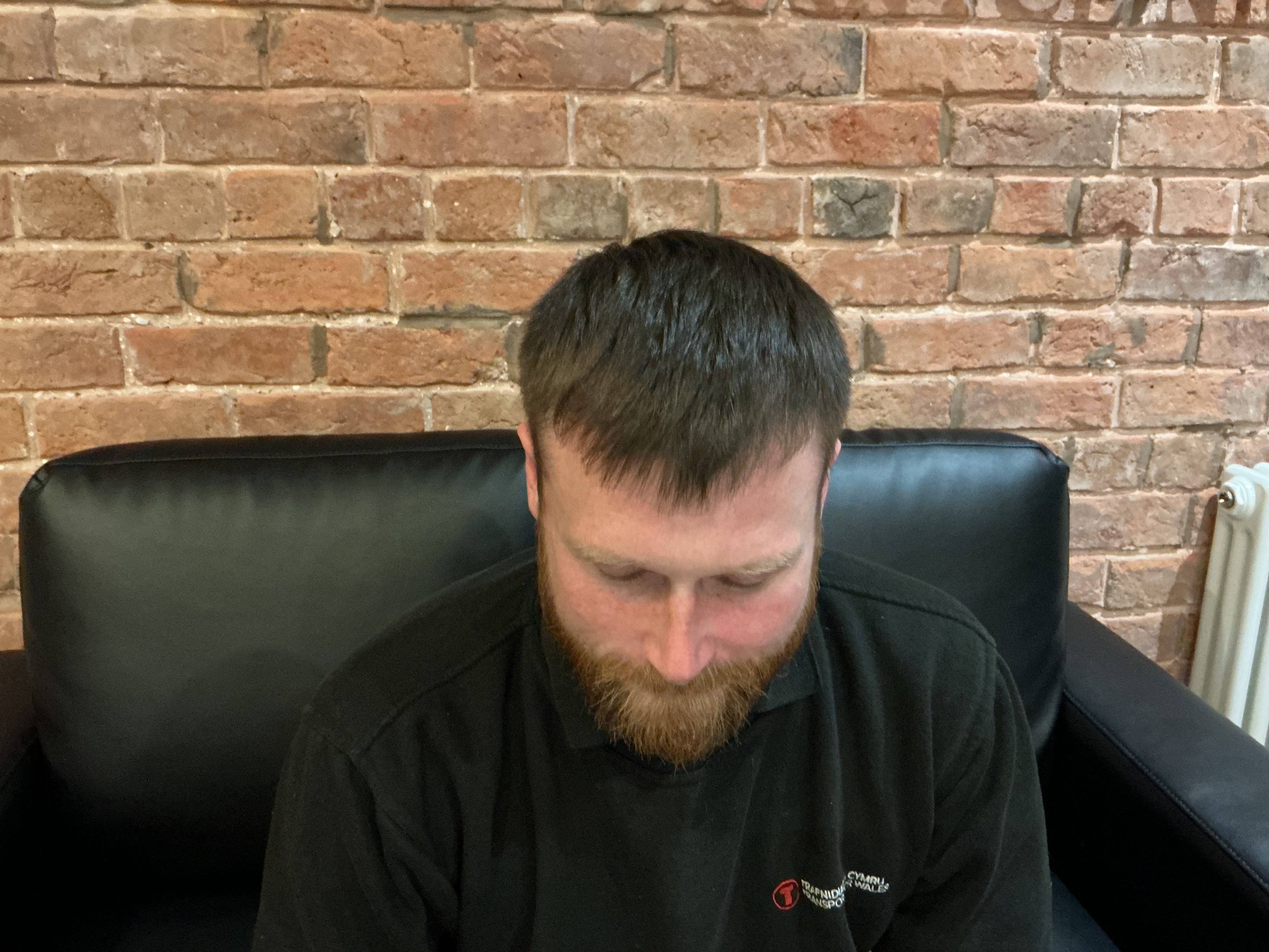 Ashley Reed hair restoration photo 7