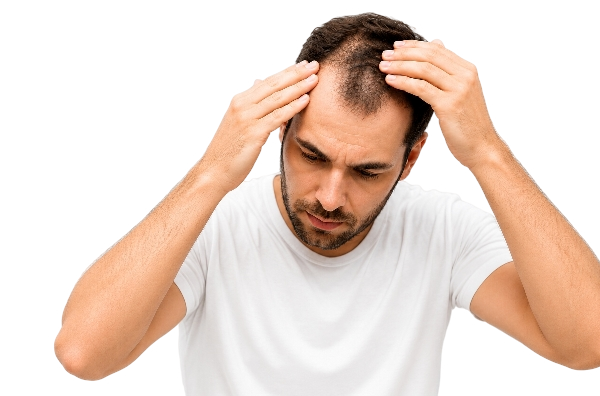 Hair loss treatment consultation at Monarch Medical Group